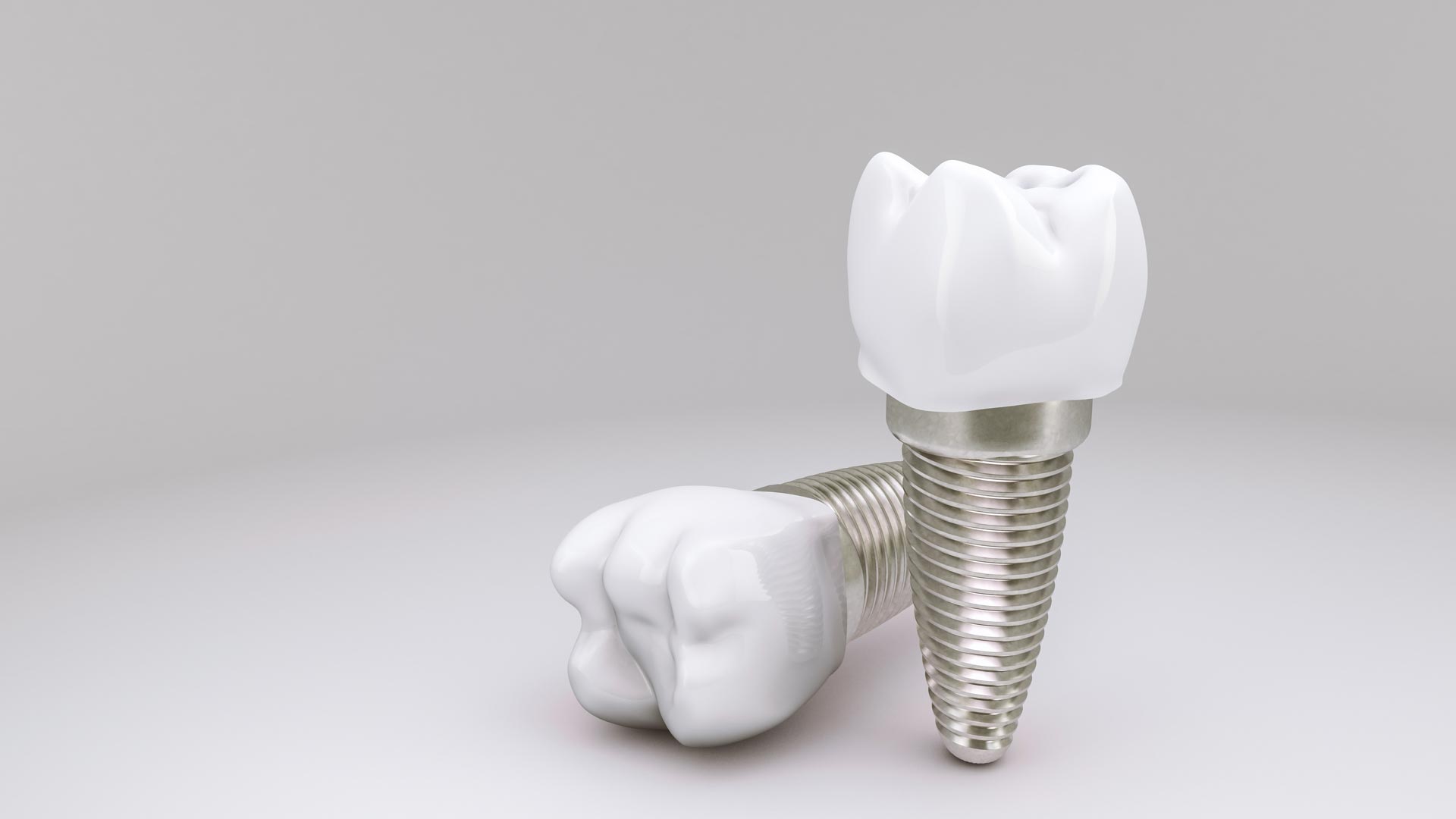 Implante dentário na CDS Odontologia Digital, no Tatuapé